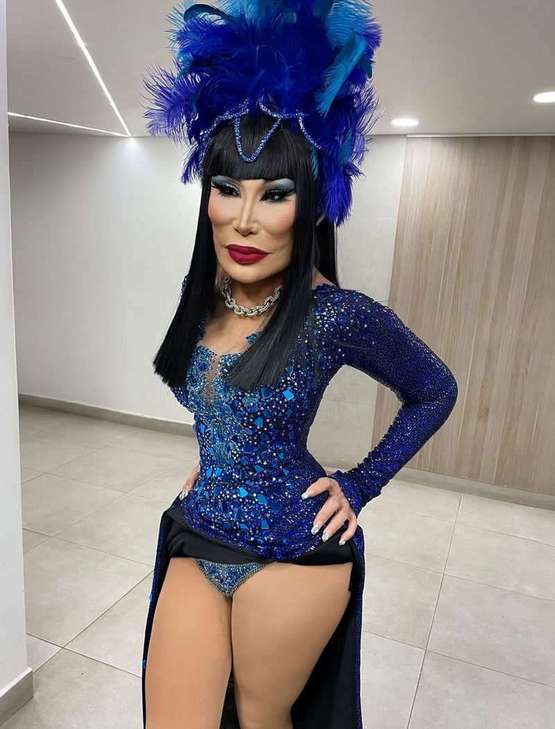 Lyn May, penari kabaret asal Meksiko yang wajahnya rusak karena filler abal-abal.