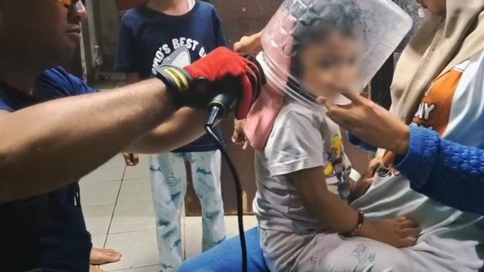 Petugas Damkar Kabupaten Temanggung saat proses pelepasan toples yang menyangkut di bocah perempuan berusia 2 tahun, Senin (23/6/2025) malam.