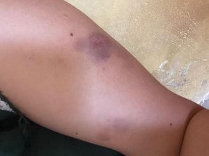 Kasus Polisi Aniaya Pacar gegara Tak Dipinjamkan HP di Gorut Berakhir Damai