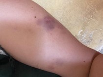 Oknum Polisi di Gorontalo Utara Diduga Aniaya Pacar gegara Tak Dipinjamkan HP