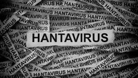 Kemenkes Gerak Cepat Siapkan 198 RS, Antisipasi Hantavirus Jadi KLB