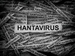 Warga Kupang Positif Hantavirus gegara Sering Tangkap Tikus