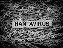 Warga Kupang Positif Hantavirus gegara Sering Tangkap Tikus