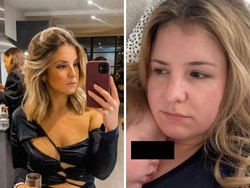 Bukan Glow Up, Orang-orang Ini Justru Merasa Makin Glow Down