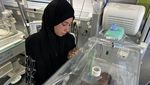 Potret Pilu Bayi di Gaza Malnutrisi, Tubuhnya Kurus Kering Kekurangan Gizi