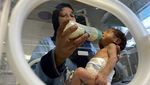 Potret Pilu Bayi di Gaza Malnutrisi, Tubuhnya Kurus Kering Kekurangan Gizi