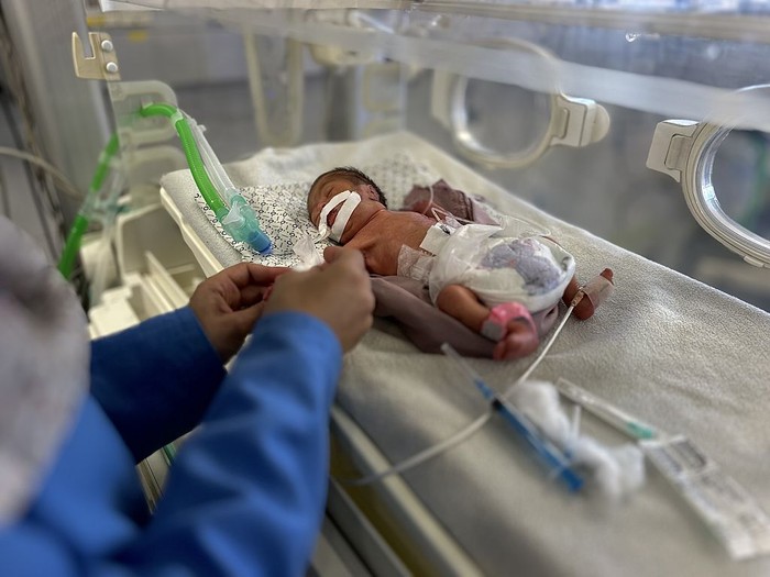 KHAN YUNIS, GAZA - JUNE 19: Premature babies are being treated amid Israeli attacks at the Nasser Hospital as they are at risk due to a shortage of medicines, medical supplies and infant formula in Khan Yunis, Gaza on June 19, 2025. (Photo by Doaa Albaz/Anadolu via Getty Images)