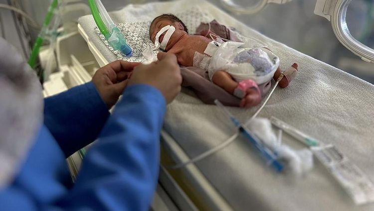 Potret Pilu Bayi di Gaza Malnutrisi, Tubuhnya Kurus Kering Kekurangan Gizi