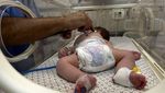 Potret Pilu Bayi di Gaza Malnutrisi, Tubuhnya Kurus Kering Kekurangan Gizi