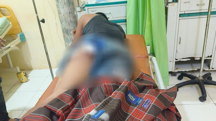 Edi Saputra yang ditembak di bagian bokong di Muratara