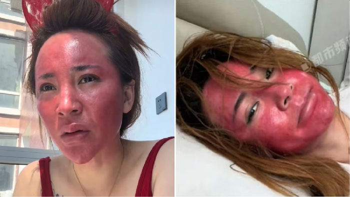 Wajah Wanita yang Tak Hapus Makeup 22 Tahun