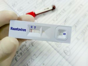 Apa Itu Virus Hanta yang Menyebar di Indonesia? Ini Gejalanya