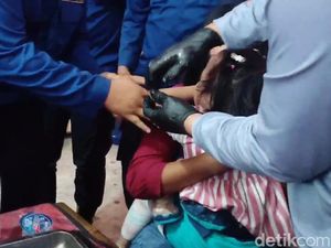 Tangis Histeris Balita di Palembang Saat Damkar Evakuasi Cincin di Jarinya
