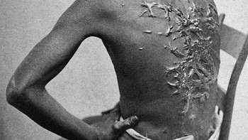 Seorang pria kulit hitam bernama Gordon, seorang budak yang melarikan diri dari perkebunan di negara bagian Louisiana, Amerika Serikat, pada tahun 1863, selama masa Perang Saudara Amerika. Bagian punggung Gordon menunjukkan luka-luka parah akibat cambukan brutal yang dilakukan oleh majikannya. Luka itu telah meninggalkan bekas permanen, membentuk pola mengerikan di kulitnya. Foto: Boredpanda