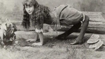 Ella Harper, yang dikenal sebagai Gadis Unta, lahir dengan kondisi ortopedi yang sangat langka yang menyebabkan lututnya menekuk ke belakang, yang disebut Congenital Genu Recurvatum. Foto: Boredpanda