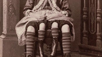 Josephine Myrtle Corbin, Wanita Berkaki Empat (1890-an) Foto: Boredpanda