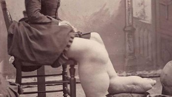Foto ini adalah potret bersejarah dari seorang perempuan bernama Fanny Mills, yang dikenal pada akhir abad ke-19 sebagai “The Ohio Big Foot Girl.” Ia menjadi terkenal karena kondisi medis langka yang menyebabkan ukuran kaki dan kakinya membesar secara tidak normal. Foto: Boredpanda