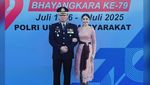 Uut Permatasari Ungkap Reaksi Suami Usai 3 Bulan Oplas