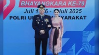 Uut Permatasari mengungkapkan reaksi suami setelah melihat wajahnya habis dioperasi. Dia bilang iya masih sama wajahnya. Mungkin sama waktu saya belum punya momongan kali ya. Kan beda kan pengantin baru, katanya. (Foto: dok Instagram uutpermatasari)