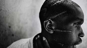 Dijpret oleh oleh James Natcheway. Gambar ini menceritakan genosida yang terjadi di Rwanda. Pria Hutu ini berada di salah satu kamp konsentrasi dan disiksa secara brutal. Ia kemudian berhasil bertahan hidup setelah dibebaskan. Foto: 121cliks