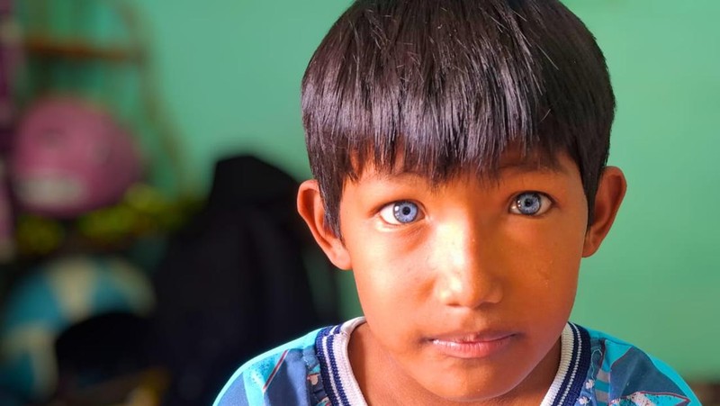 Arjuna, bocah Tarakan yang punya mata berwarna biru. Foto: Oktavian Balang/detikKalimantan