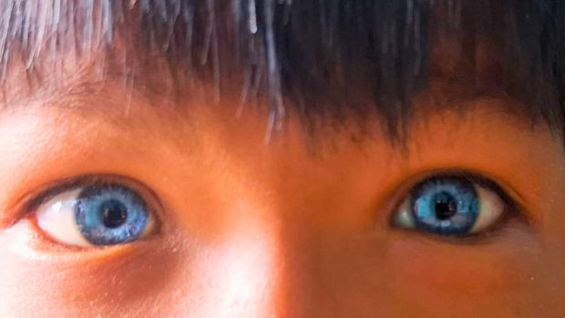 Arjuna, bocah Tarakan yang punya mata berwarna biru. Foto: Oktavian Balang/detikKalimantan