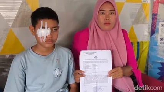 Siswa SMP di Gowa yang terkena ketapel tusuk bakso oleh rekannya di bagian mata kanannya resmi kembali melapor ke polisi didampingi orang tuanya.