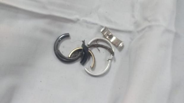 Proses evakuasi cincin di kemaluan pria di Ciamis.