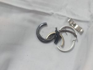 Sederet Fakta 4 Cincin Nyangkut di Kemaluan Dudung
