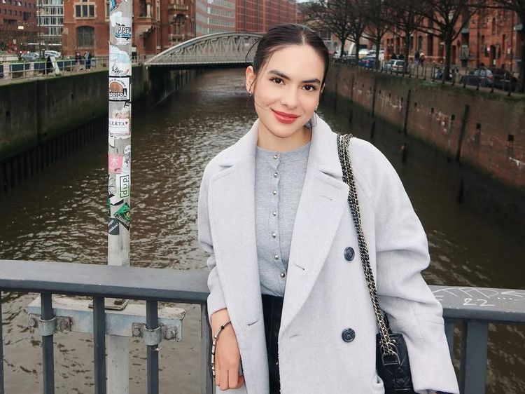 Steffi Zamora Akui Dulu Bule Ireng, Sekarang Putih karena Suntik?