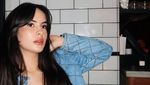 Steffi Zamora Akui Dulu Bule Ireng, Sekarang Putih karena Suntik?