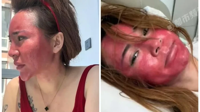 Viral wajah rusak karena tak pernah hapus makeup