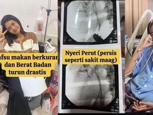 Wanita Samarinda Kena Kanker Saluran Empedu Stadium 4 di Usia 38, Inikah Pemicunya?