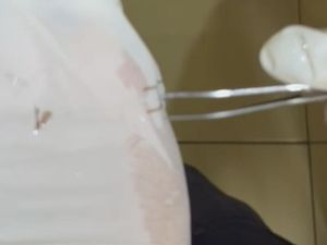 Damkar Tasik Evakuasi Kawat Staples Nyangkut di Tenggorokan Remaja