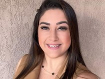 Cerita Wanita Idap Gigantomastia, Tersiksa karena Payudaranya Terus Membesar