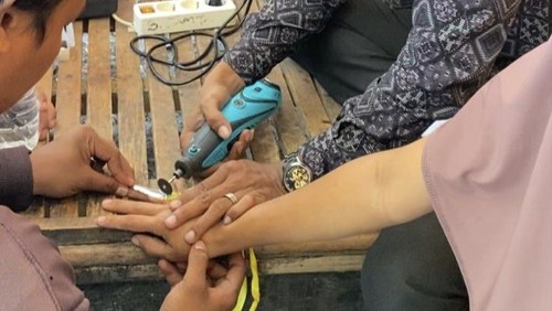 Petugas Damkarmat Kabupaten Bima mengeluarkan cincin dari jari manis seorang perempuan, pada Kamis, (17/7/2025).