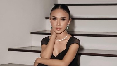 Yuni Shara Makin Terang Usai Operasi Mata