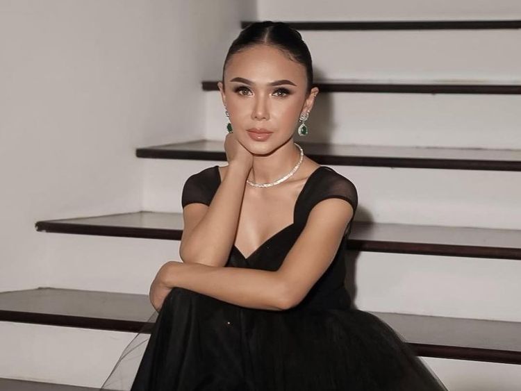 Yuni Shara Makin Terang Usai Operasi Mata