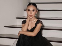 Yuni Shara Makin Terang Usai Operasi Mata