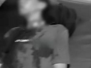 Viral Pria Luka di Kepala Gegara Tawuran di Jonggol Bogor, Polisi Lacak Pelaku