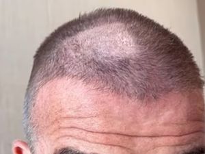 Salah Potong Rambut, David Beckham jadi Pitak