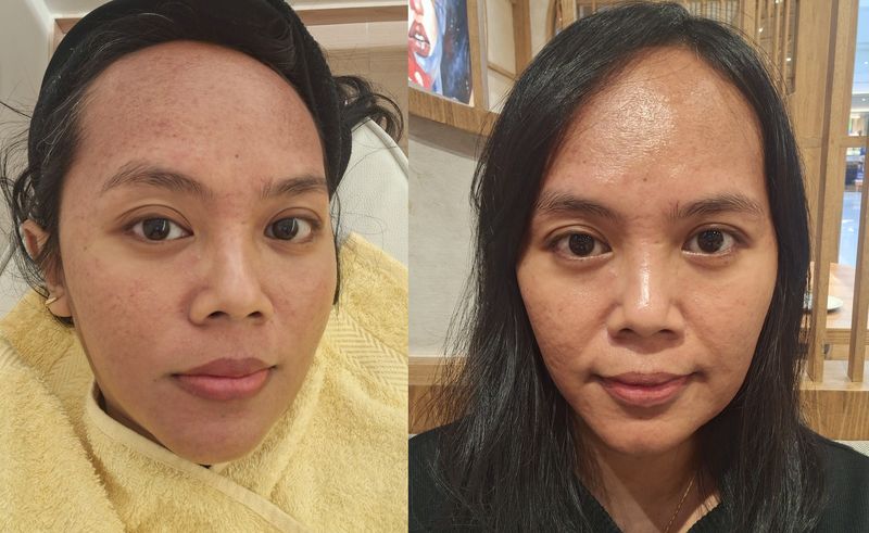 Liff Facial Studio di Mall Kelapa Gading, Jakarta Utara.