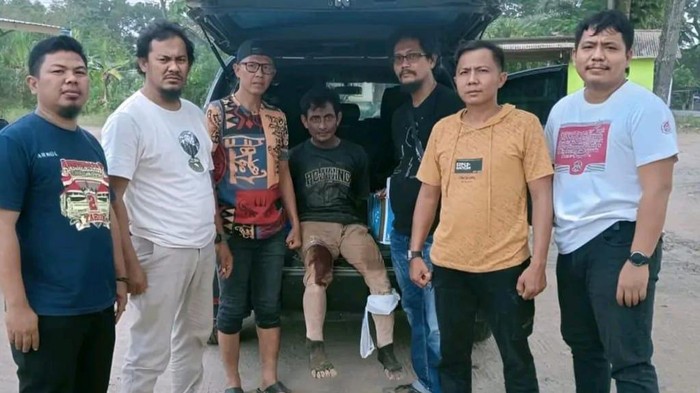 Haryanto, pelaku pemerkosaan dan pembunuhan bocah di Lampung usai ditembak polisi.