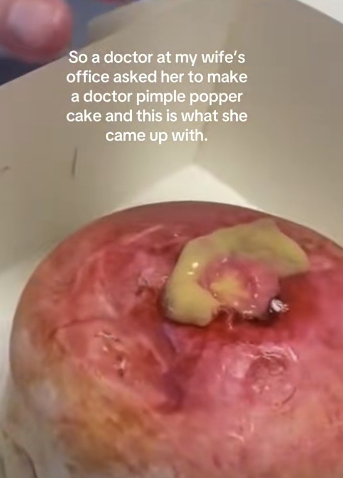 Kue menjijikkan Kue menjijikkan