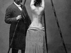 Aneh dan Seram! Begini Alat Medis Zaman Dulu Sebelum Teknologi Canggih