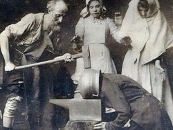 Aneh dan Seram! Begini Alat Medis Zaman Dulu Sebelum Teknologi Canggih