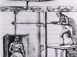 Aneh dan Seram! Begini Alat Medis Zaman Dulu Sebelum Teknologi Canggih