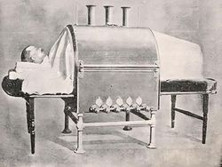 Aneh dan Seram! Begini Alat Medis Zaman Dulu Sebelum Teknologi Canggih