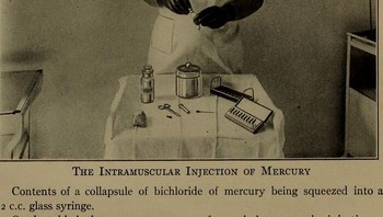 Sejak abad ke-16, merkuri telah digunakan sebagai pengobatan sifilis meskipun sangat beracun bagi tubuh manusia. Banyak pasien mengalami efek samping yang parah seperti kerusakan saraf, kegagalan organ, dan bahkan kematian setelah menjalani perawatan merkuri. Suntikan merkuri tetap populer hingga awal abad ke-20 ketika penisilin, pengobatan yang jauh lebih efektif, akhirnya ditemukan. Foto: Boredpanda