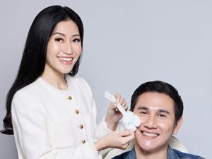 Vino G. Bastian Ungkap Transformasi Wajah Setelah Rutin Perawatan di Usia 43